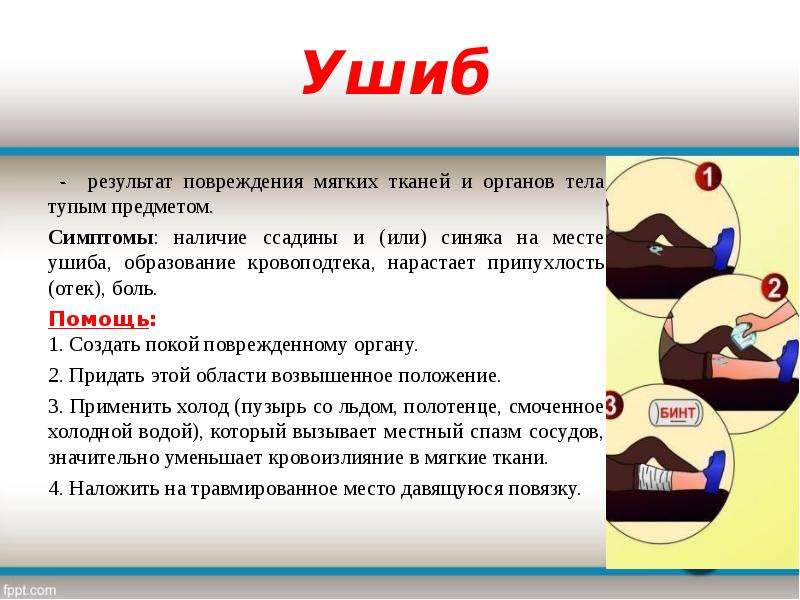 Как лечить ушиб. Первая помощь при ушибах мягких тканей. Ушиб мягких тканей первая помощь. 1 Помощь при ушибах мягких тканей. Оказание доврачебной помощи при ушибах мягких тканей.