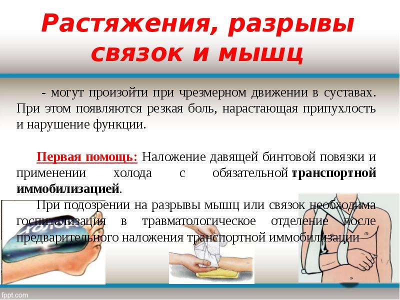 Растяжение симптомы. Растяжение признаки и первая помощь. Разрыв мышц первая помощь. Оказание первой помощи при разрывах связок и мышц. Разрыв сухожилий оказание ПМП.