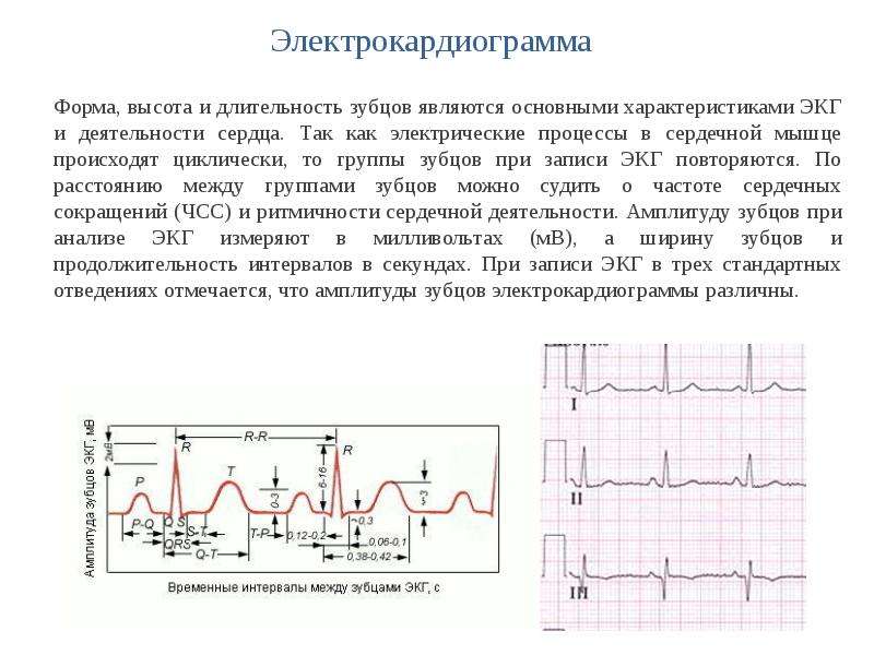 Понятие об экг презентация