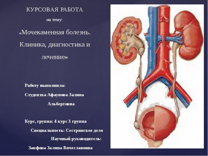 Схема лечения мочекаменной болезни