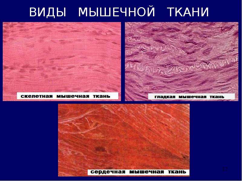 Биохимия мышечная. Мышечная ткань. Происхождение гладкой мышечной ткани. Гладкая мышечная ткань нейрального происхождения. Мышечные ткани эпидермального и нейрального происхождения.