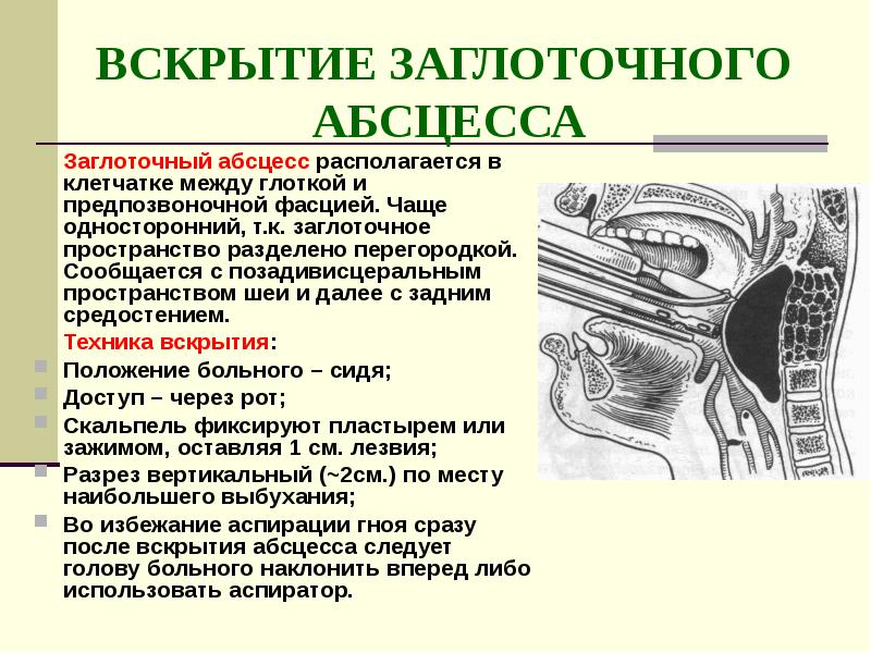 Вскрытие флегмон и абсцессов. Позадиглоточное пространство топографическая анатомия. Заглоточное пространство шеи анатомия. Топография заглоточного пространства. Клиническая анатомия заглоточного пространства.