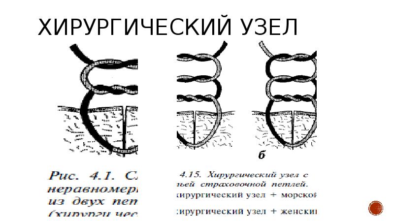 Морской хирургический узел