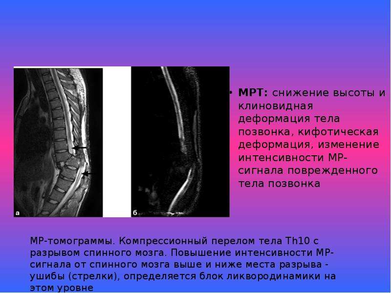 Ушиб позвоночника карта вызова