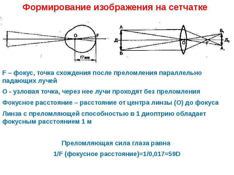 Каким будет изображение предметов на сетчатке глаза