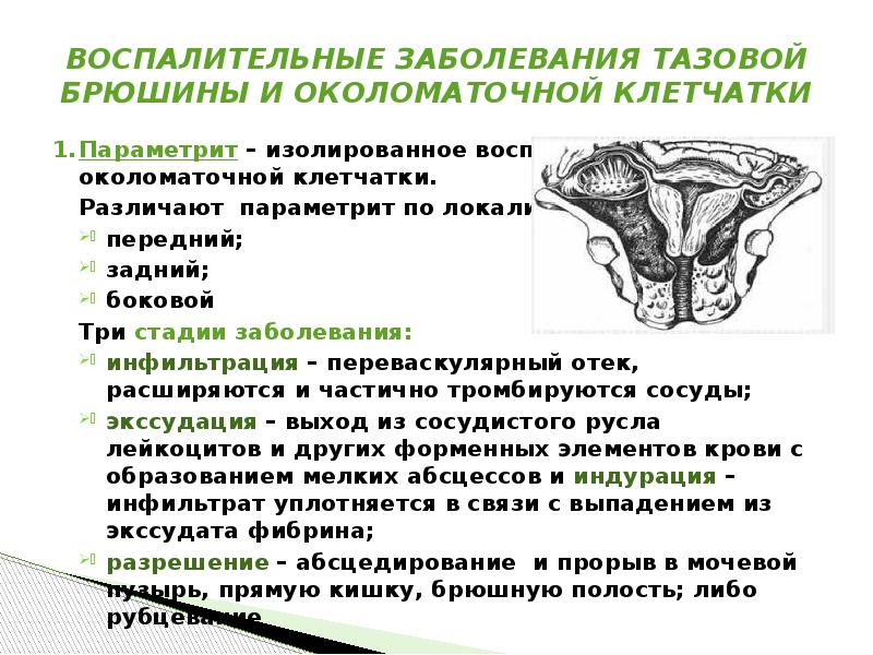 Послеродовый параметрит презентация