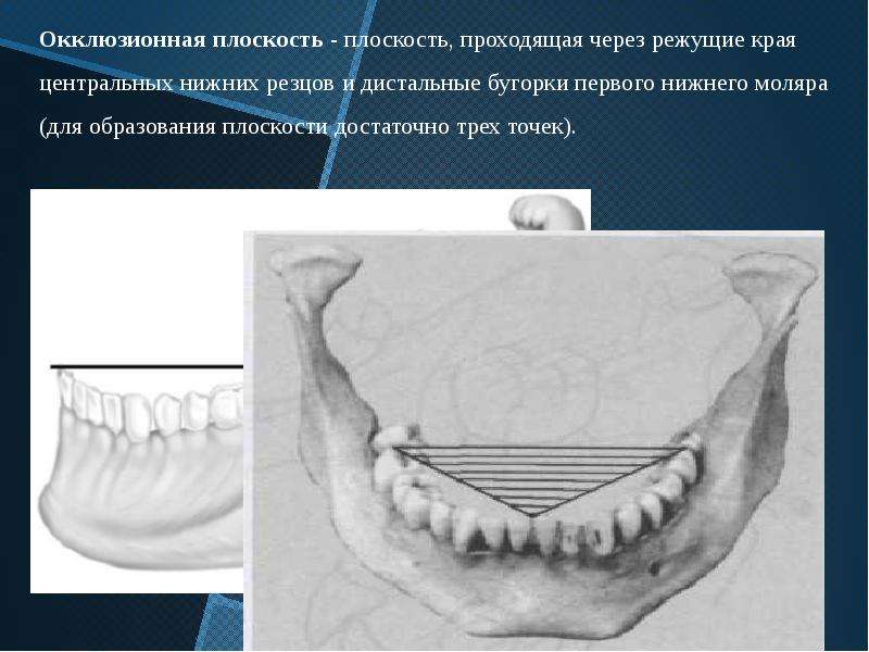 Основы окклюзионной диагностики презентация