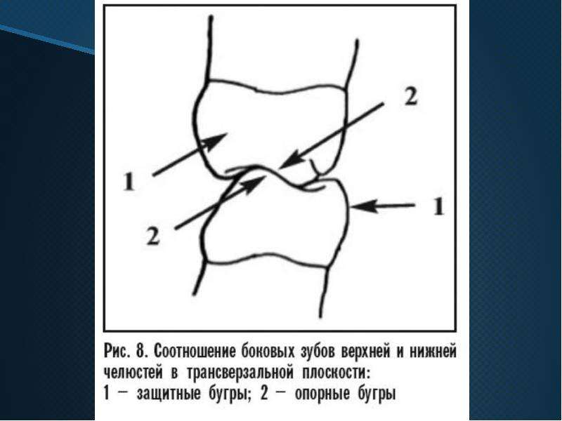 Идеальная схема окклюзионных контактов моляров и премоляров