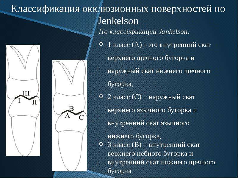 Постановка зубов по индивидуальным окклюзионным кривым презентация