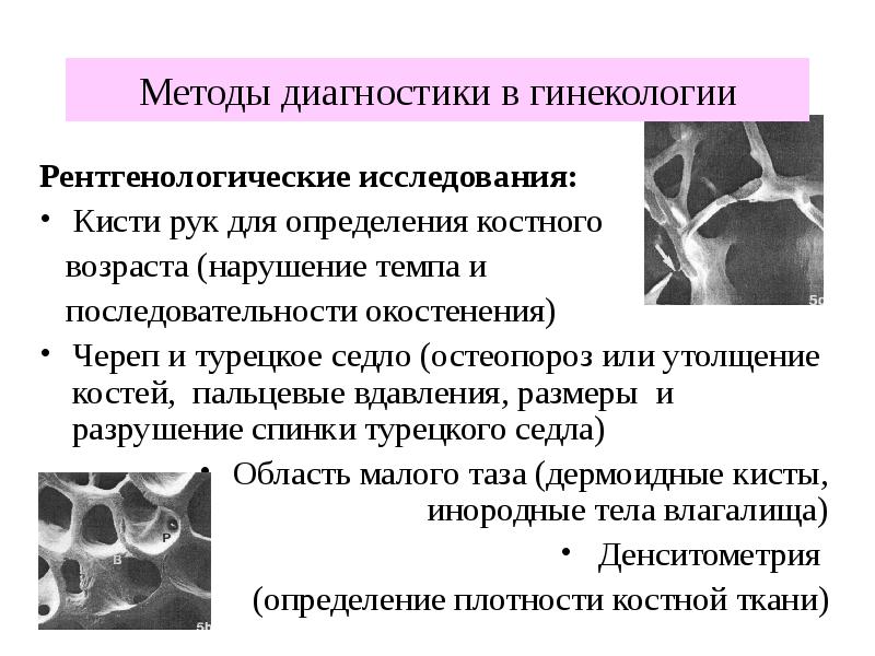 Методы обследования в акушерстве презентация