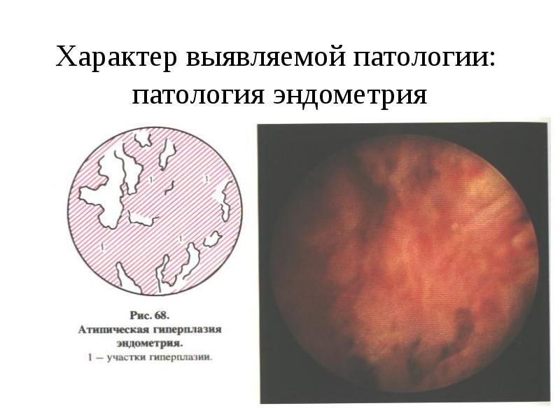 Через монитор какие обследования бывают в гинекологии