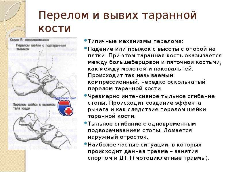 Вывих стопы карта вызова