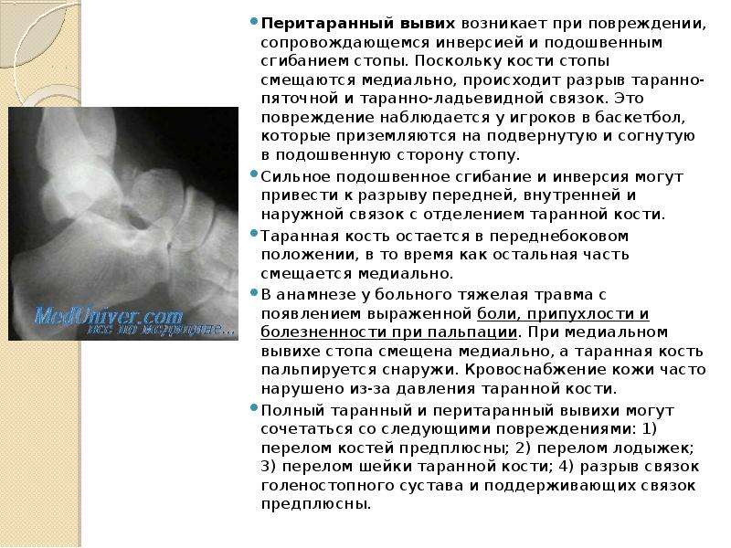 Открытая травма голени карта вызова