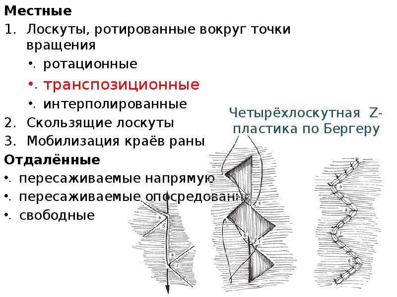 Свободный лоскут. Пластика ротационным лоскутом. Кожная пластика местными тканями. Ротационный кожные лоскуты.