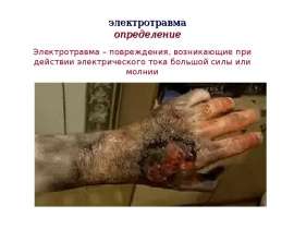 Мероприятия первой помощи при электротравме