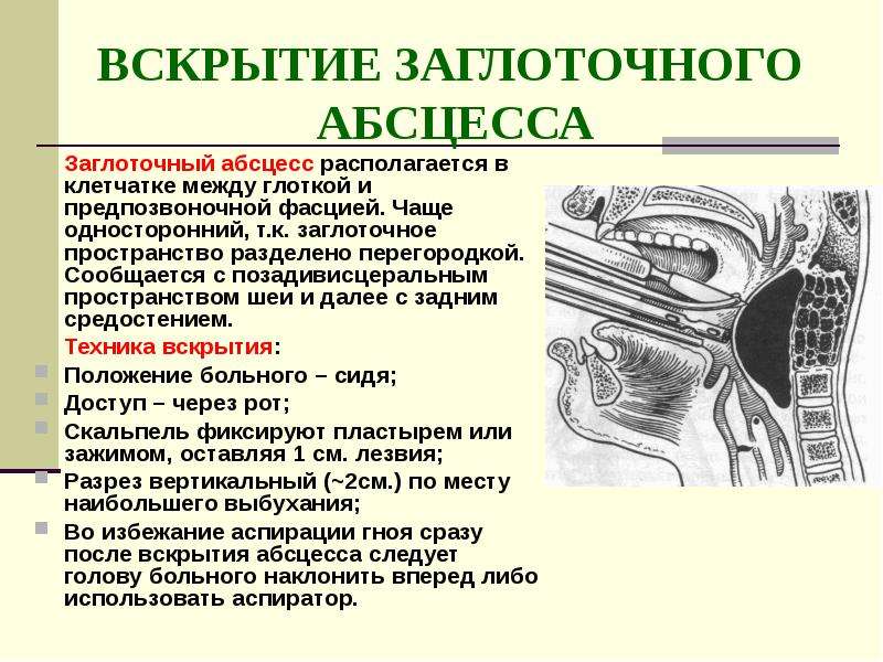 Топографическая анатомия глотки презентация