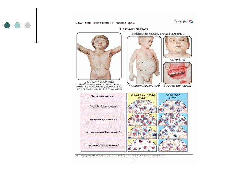 Заболевания органов пищеварения у детей. Гельминтозы. Заболевания системы крови, рис. 41