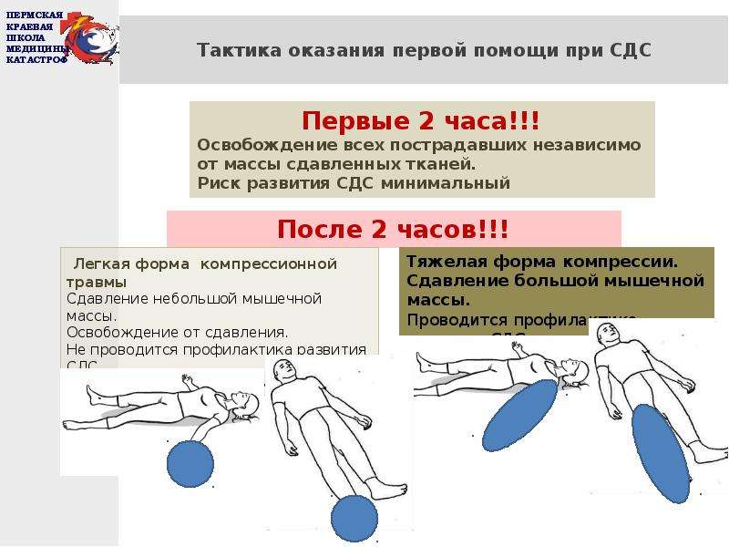 Синдром длительного сдавливания презентация медицина катастроф