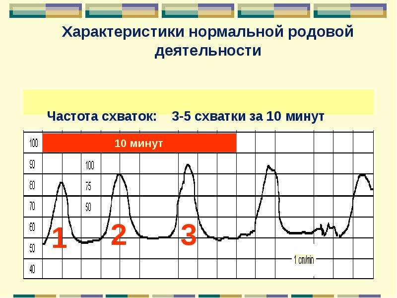 Аномалии родовой деятельности картинки