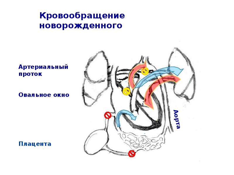 Кровообращение новорожденного схема