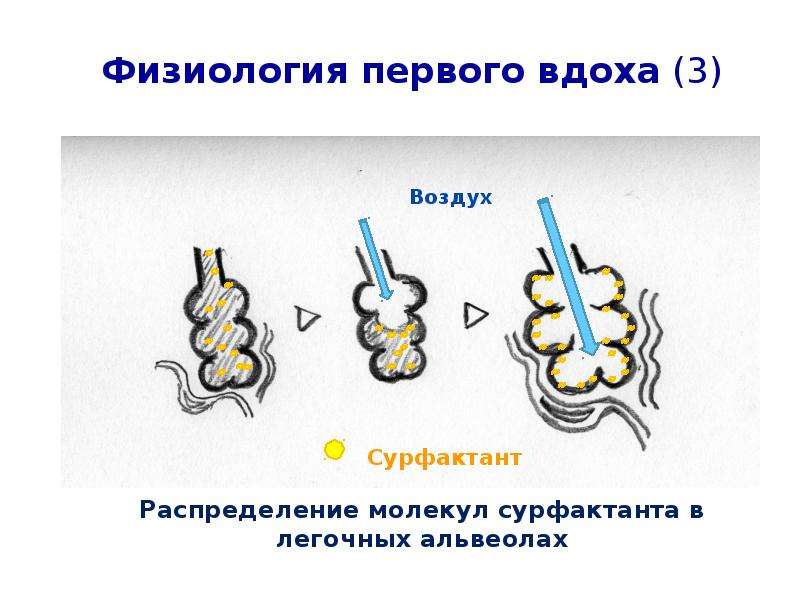 Схема первого вдоха новорожденного