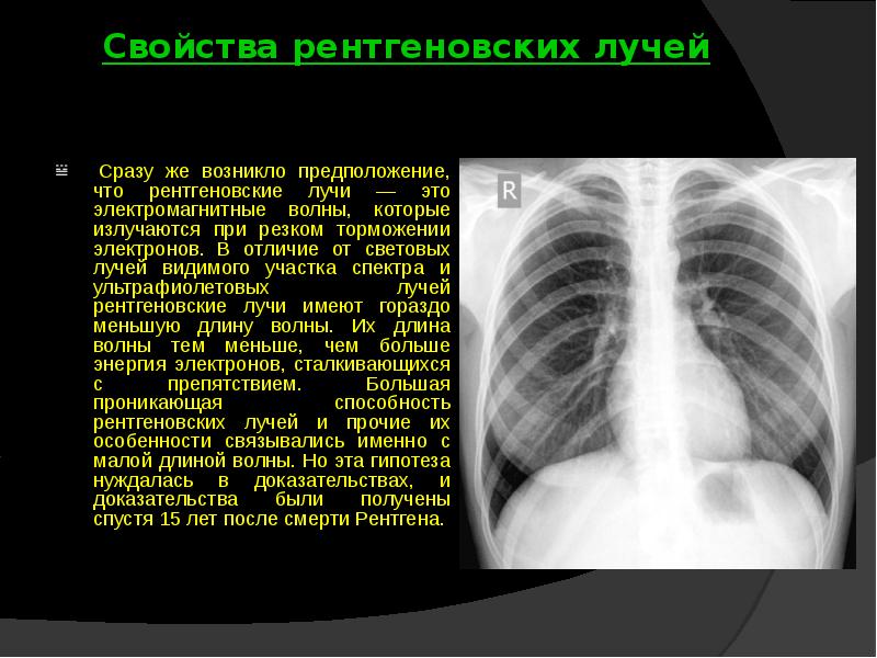 Рентгеновское излучение ответ 1