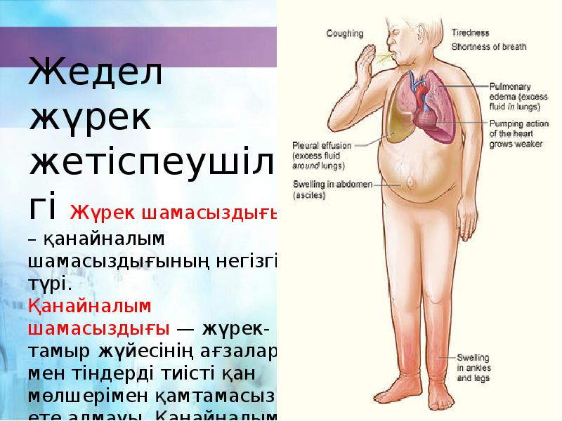 Созылмалы жүрек жетіспеушілігі презентация