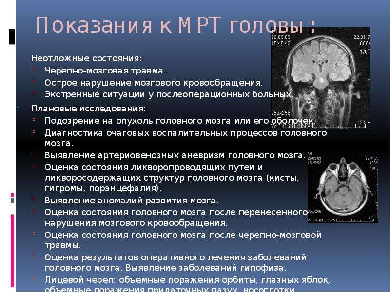 Какое мрт сделать при головных болях. Показания к мрт. Мрт головного мозга показания. Показания к проведению мрт. Показания к мрт головы.