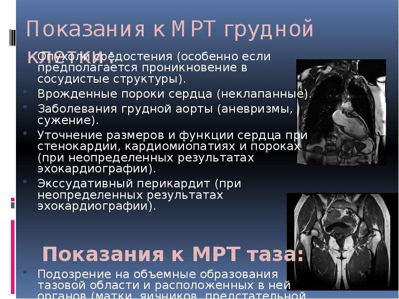 Мрт грудной клетки