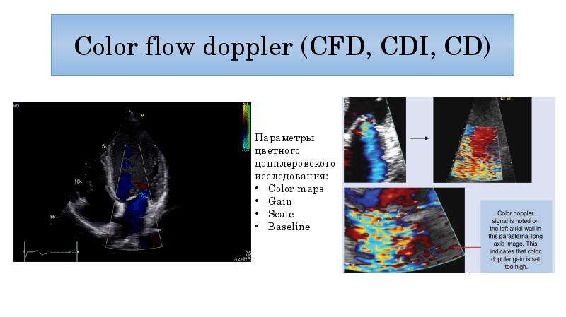 Cinemómetro de efecto doppler