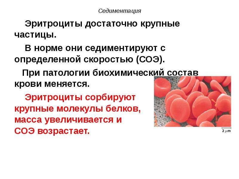 1 седиментация. Седиментация. Седиментация крови. Эритроциты и их растворы. Крупные эритроциты в крови в норме.