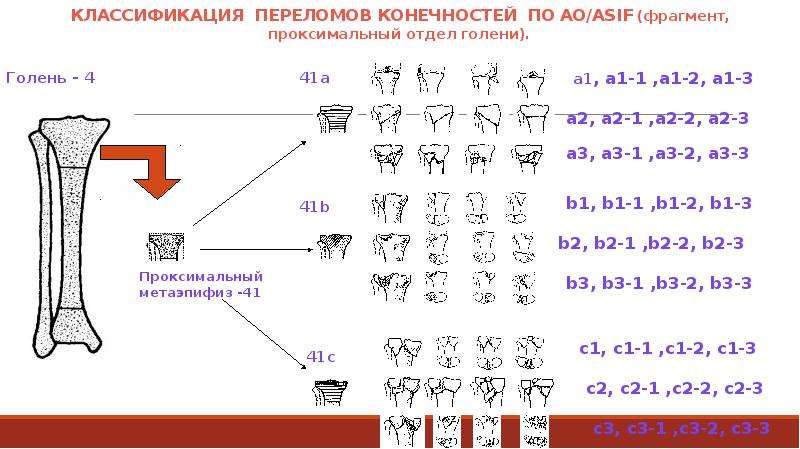 Классификация переломов. Классификация переломов позвоночника по АО Asif. Переломы проксимального отдела костей голени. Классификация переломов травматология. Переломы проксимального отдела голени.