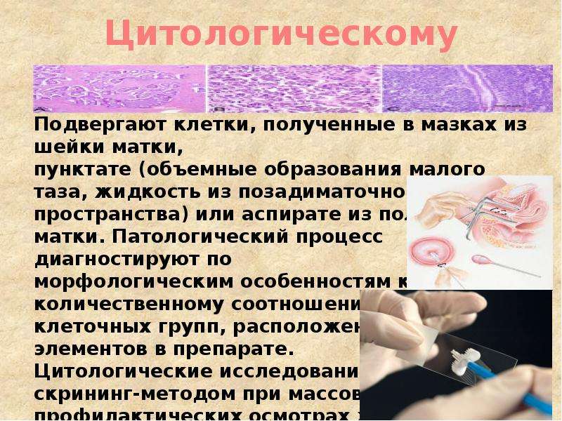 Цитологическое исследование шейки матки. Презентация на тему методы обследования гинекологических больных. Методы цитологического исследования шейки матки. Цитологические методы исследования в гинекологии. Цитологический мазок с шейки матки.