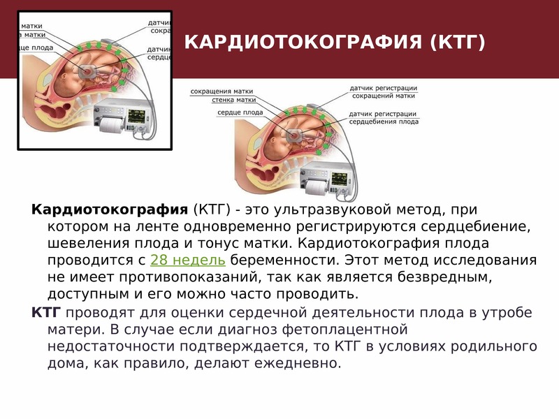 Диагностика датчиков. Кардиотокография плода презентация. КТГ мониторинг алгоритм. Тонус матки на КТГ.