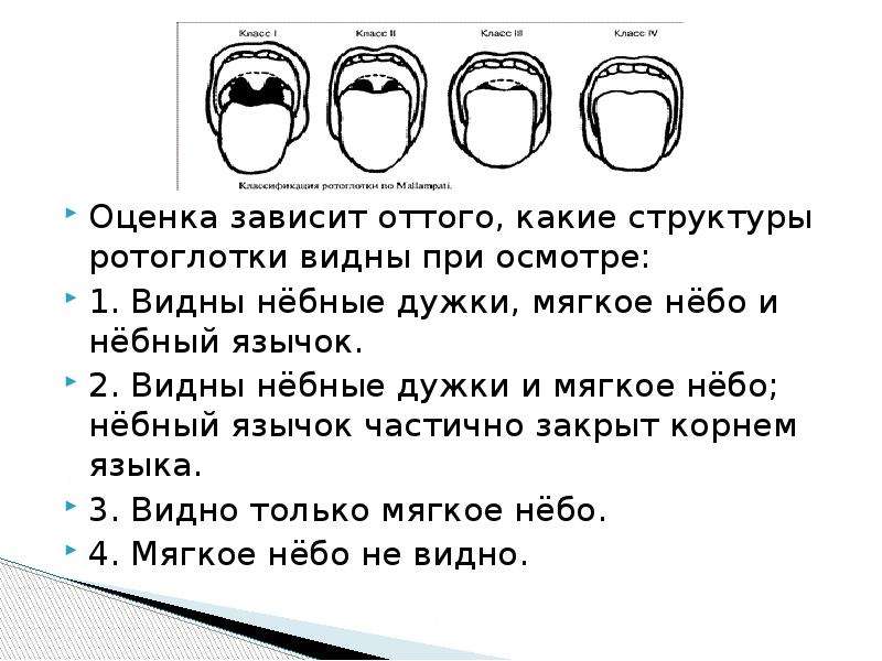 Зависит оценка. Между дужками мягкого неба расположены. Язычок мягкого неба длинный. Исследование мягкого неба алгоритм.