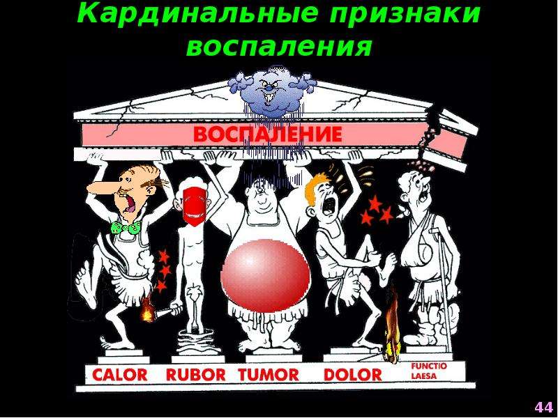 Признаки воспаления. Пять признаков воспаления. Классические признаки воспаления. Кардинальные признаки воспаления.