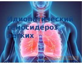 Идиопатический гемосидероз лёгких