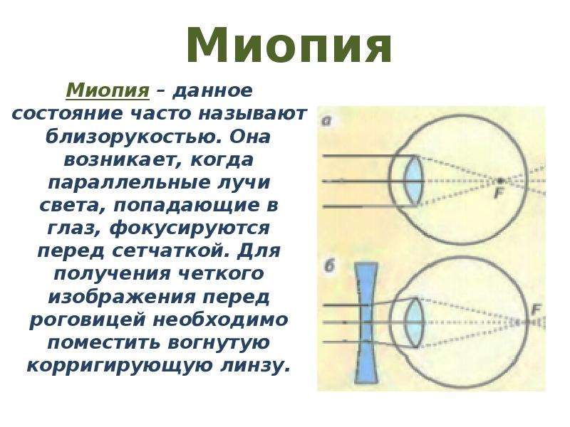 Фокусировка лучей попадающих в глаз от удаленного предмета картинка