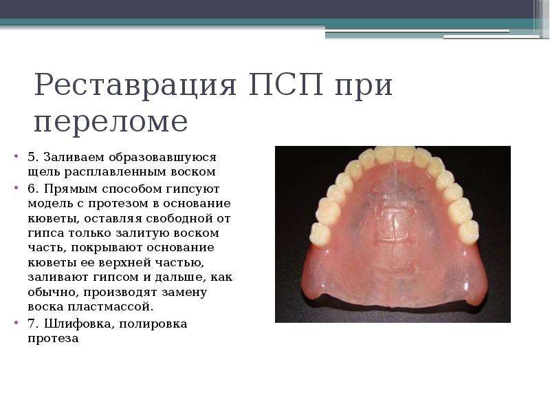 Полный съемный протез презентация