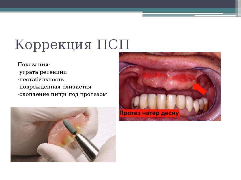 Сколько стоит починка псп