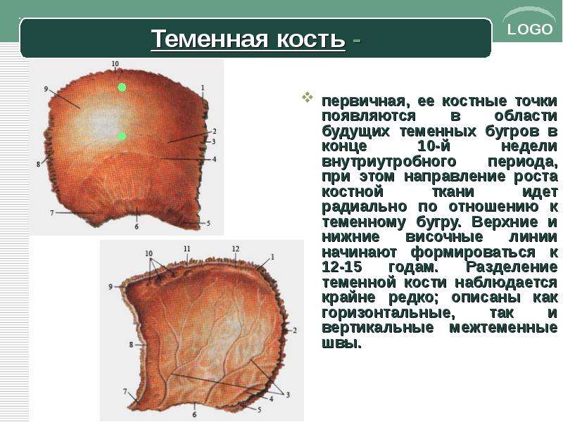 Теменная кость черепа. Теменная кость бугор. Теменная кость пальцевидные вдавления. Верхняя височная линия теменной кости.