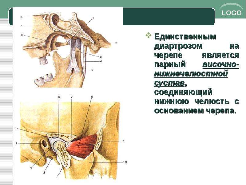 Соединение нижнечелюстной и височной кости. Височно-нижнечелюстной сустав на черепе. Височно-нижнечелюстной сустав является. Нижняя челюсть соединена суставом с.