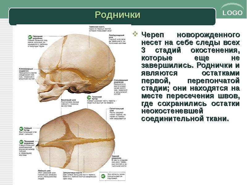 Сколько родничков у младенцев. Роднички у детей анатомия. Темечко на черепе. Роднички черепа. Роднички черепа новорожденных.