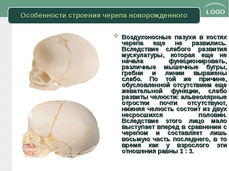 Чем можно объяснить легкость черепа. Афо черепа новорожденного. Строение свода черепа новорожденного. Особенности строения костей свода черепа у детей. Кости свода черепа строение.