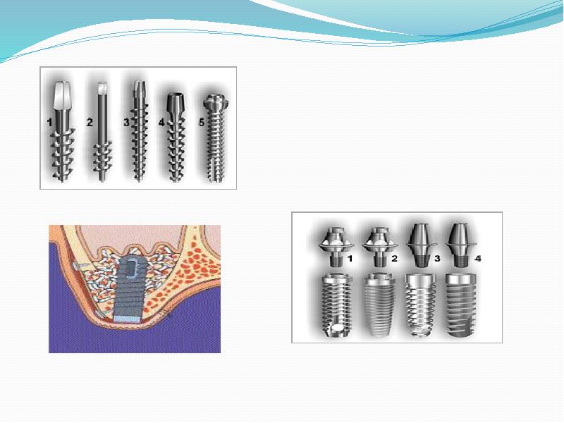 Хирургический инструментарий и медикаментозное сопровождение дентальной имплантации презентация