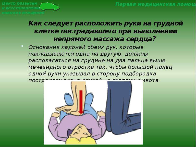 При проведении закрытого массажа сердца грудину. При непрямом массаже сердца глубина продавливания. При выполнении непрямого массажа сердца следует располагать ладонь. Непрямой массаж сердца руки располагаются. Точка давления на грудину при проведении непрямого массажа сердца.