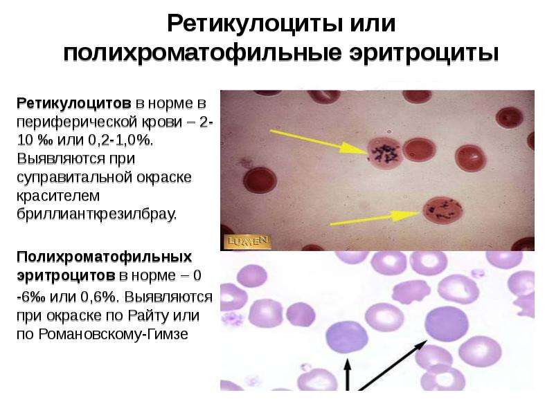 Ретикулоциты это. Ретикулоциты подсчет клеток. Ретикулоциты суправитальная окраска. Ретикулоциты 12%. Ретикулоциты 2%.