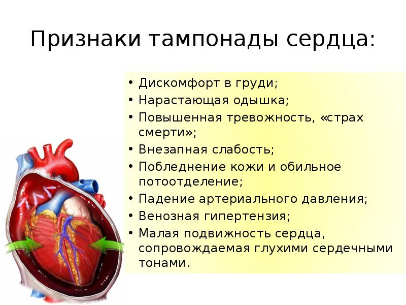 Признаки тампонады сердца: Дискомфорт в груди; Нарастающая одышка; Повышенная тревожность, «страх см
