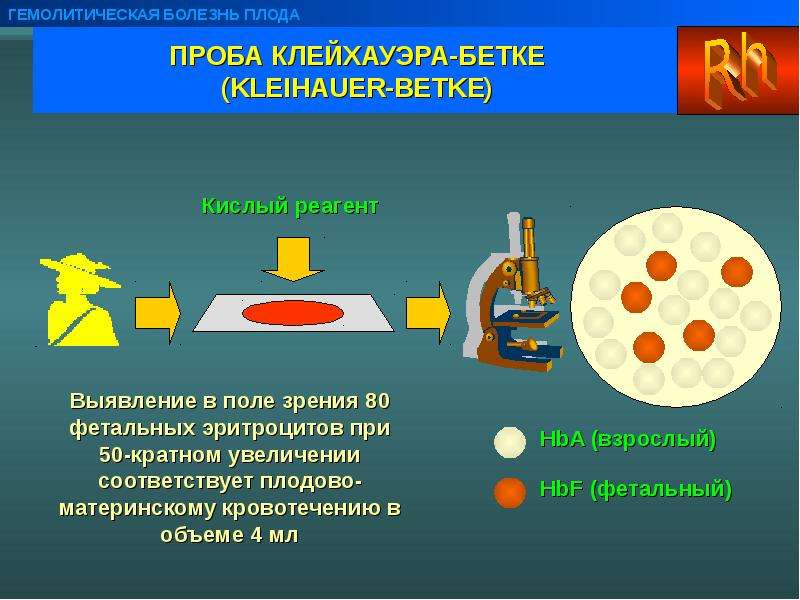 Увеличение соответствующих. Проба Клейхауэра-бетке. Тест Клейхауэра бетке. Гемолитическая салфетка. Проба на гемолитическую болезнь.