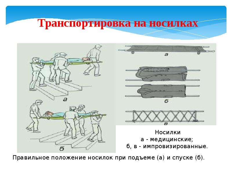 Виды транспортировки. Транспортировка на носилках. Транспортировка на носилках каталке. Перемещение пациента на носилках.